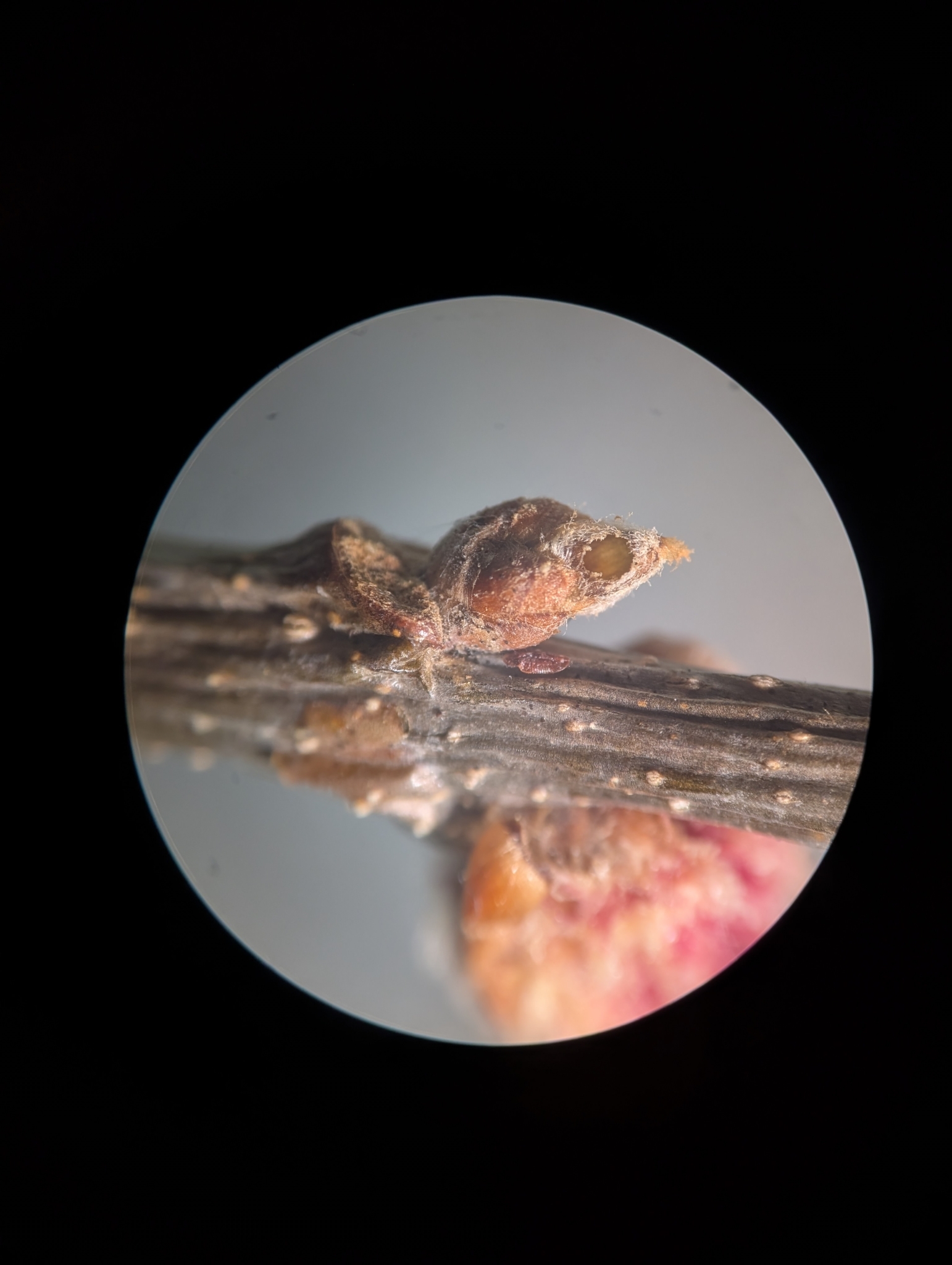 Gall image